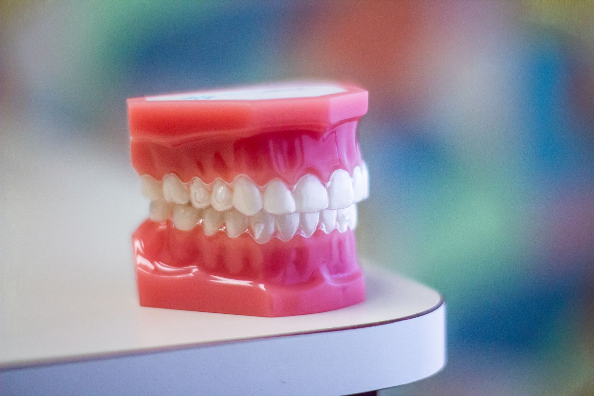 Set of Benbrook clear aligners on a model of teeth.